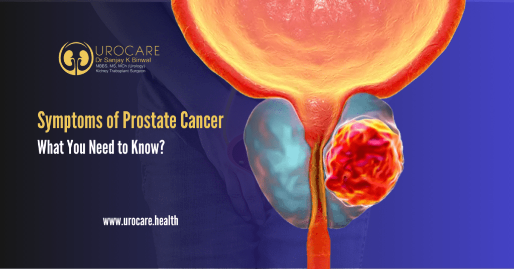 Symptoms of Prostate Cancer
