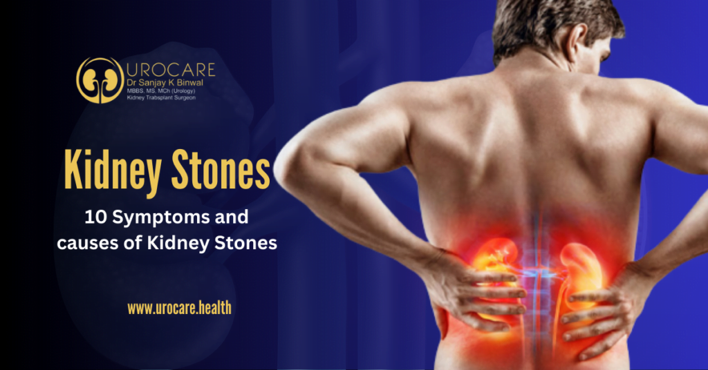 10 Symptoms and causes of Kidney Stones