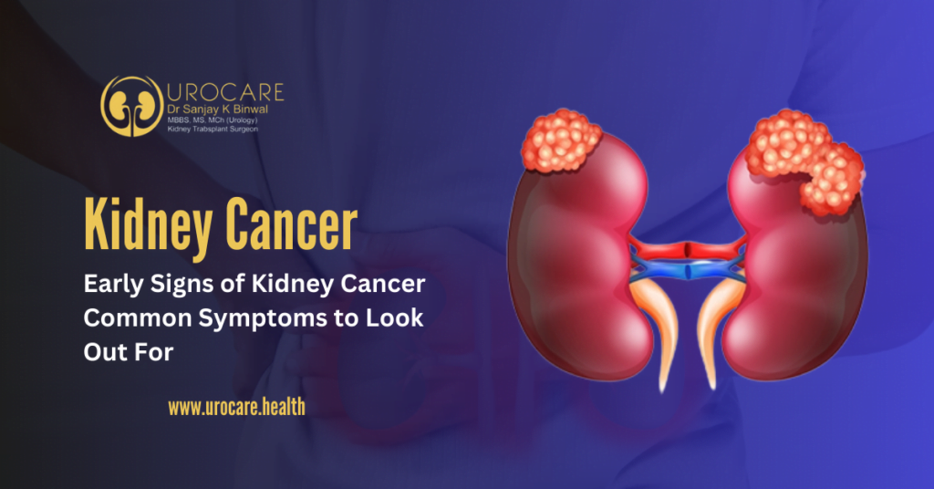 Early Signs of Kidney Cancer