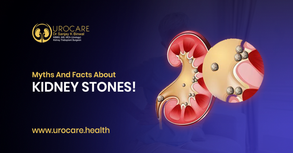 Myths And Facts About Kidney Stones! 1 Myths And Facts About Kidney Stones