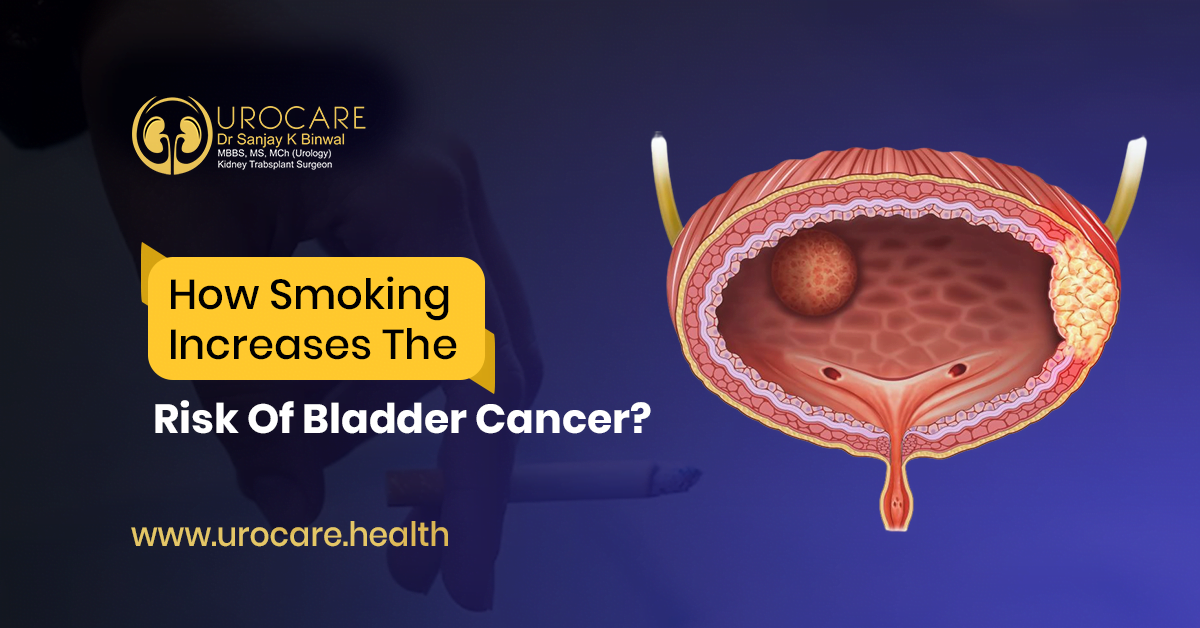 How Smoking Increases The Risk Of Bladder Cancer?