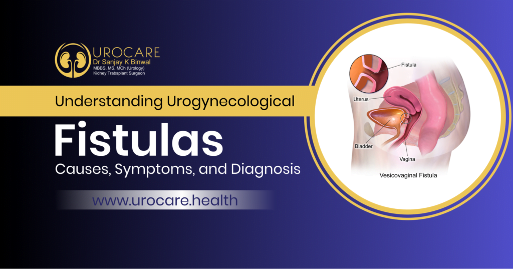 Urogynecological Fistulas
