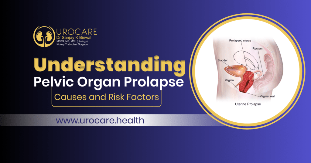 Pelvic Organ Prolapse