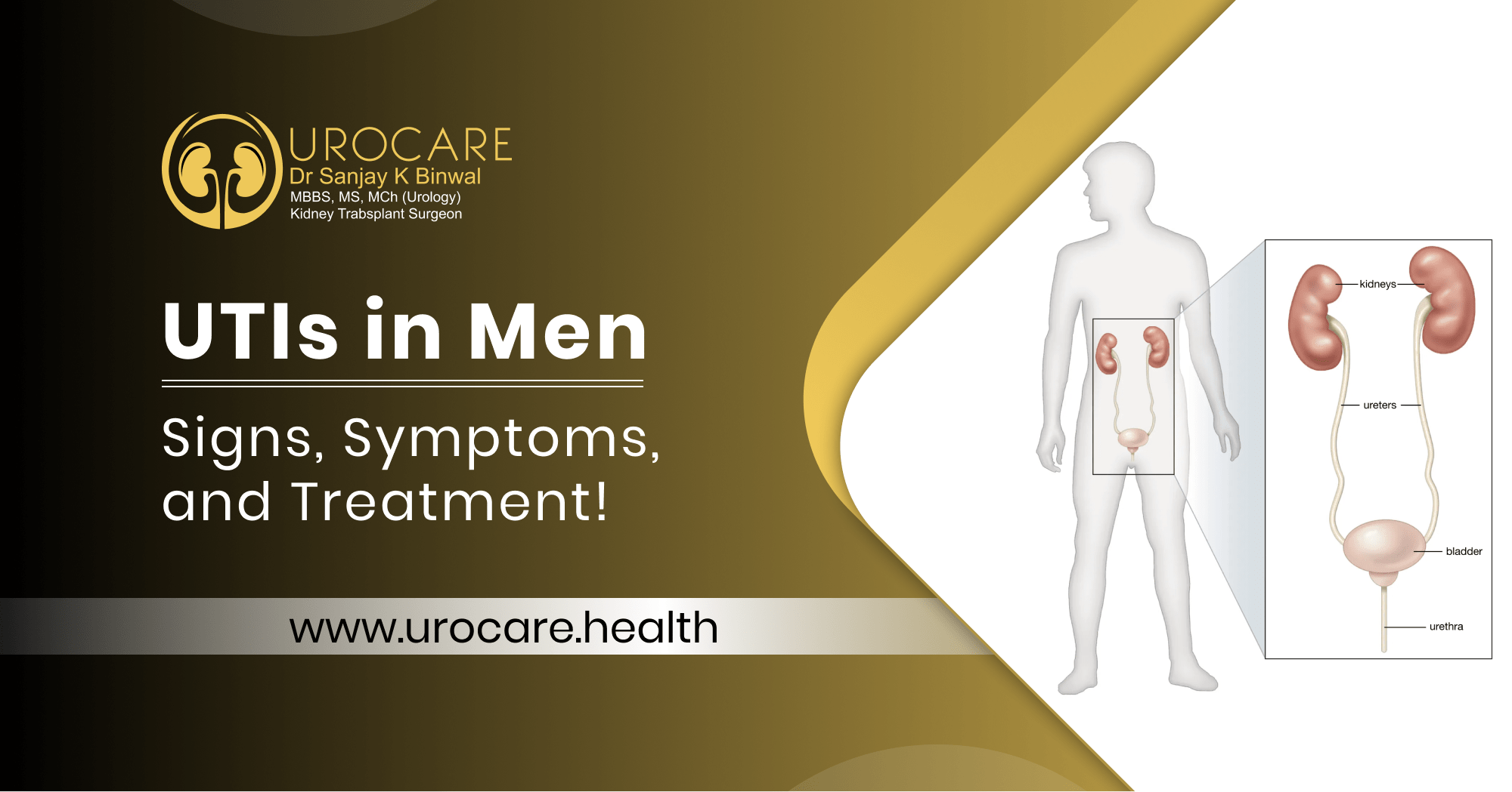 UTIs in Men: Signs, Symptoms, and Treatment!