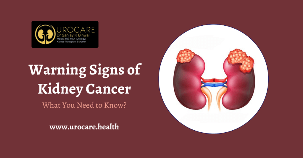 Warning Signs of Kidney Cancer