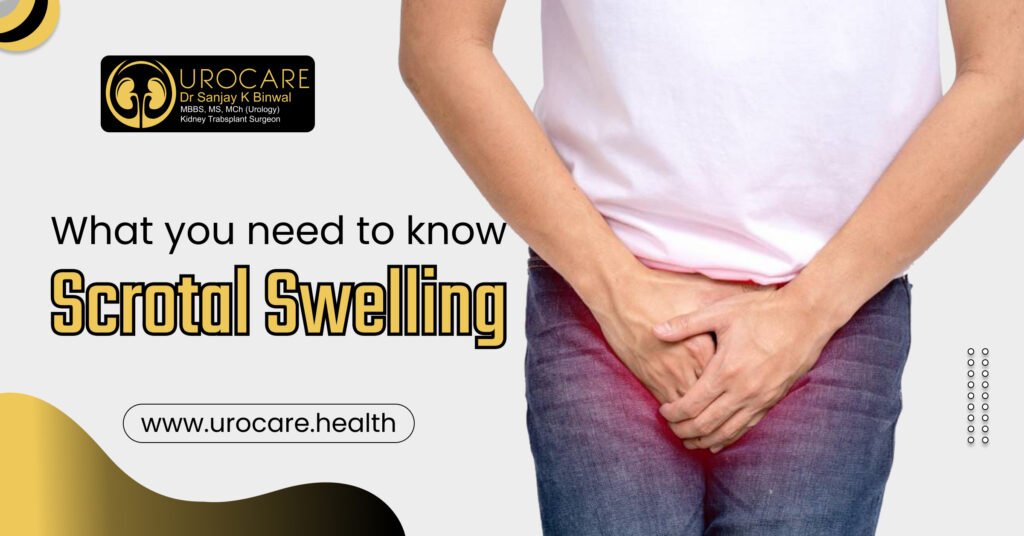What You Need to Know About Scrotal Swelling