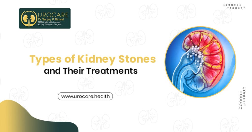 best kidney stone specialists in Jaipur