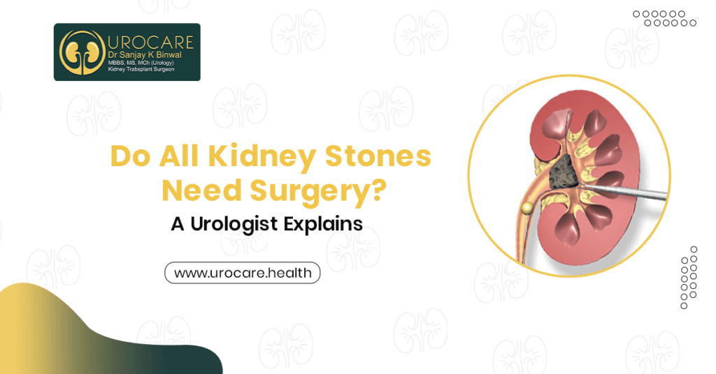 Do All Kidney Stones Need Surgery? A Urologist Explains 1 Do All Kidney Stones Need Surgery