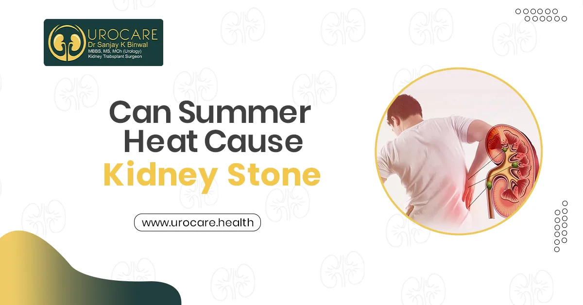 Can Summer Heat Cause Kidney Stones?