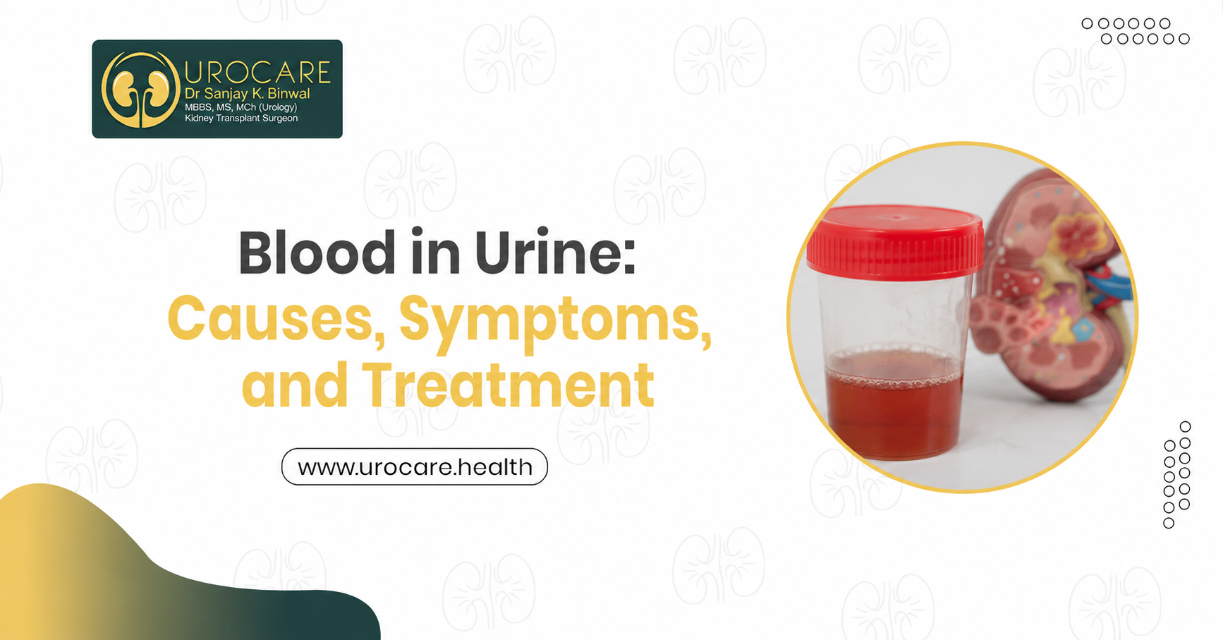 Blood in Urine: Causes, Symptoms, and Treatment